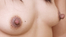 Nipple Reduction