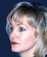rhinoplasty