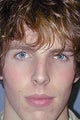 Nose Surgery, Rhinoplasty