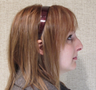 Rhinoplasty