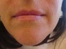 Lips 