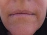 Lips 