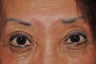 Permanent Makeup