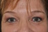 Permanent Makeup