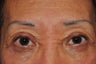 Permanent Makeup