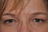 Permanent Makeup