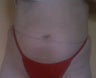 Smart Lipo