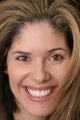 Eight porcelain veneers on upper teeth closing midline space.
