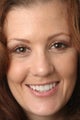 Smile Makeover With Porcelain Veneers