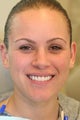 Porcelain Veneers