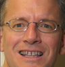 Porcelain Veneers