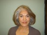Facelift, Mini Face Lift, Quicklift