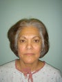 Facelift, Mini Face Lift, Quicklift