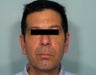 The Liquid Facelift for a Man