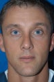 Rhinoplasty