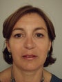 Revision Rhinoplasty