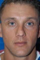 Rhinoplasty