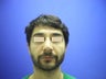 Rhinoplasty