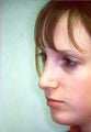 Rhinoplasty