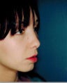 Rhinoplasty
