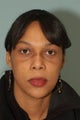 Rhinoplasty