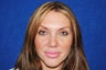 Female Rhinoplasty (Nose Job)