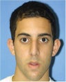 Rhinoplasty