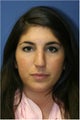 Rhinoplasty
