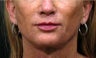 Sculptra, Juvederm, Obagi