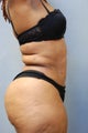 Wrap around Abs