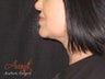 Smart Lipo-Chin
