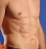 Smart Lipo