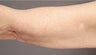 Smart Lipo