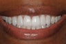 Cosmetic Dentistry