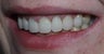 Sedation Dentistry