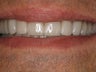 Tetracycline Repair
