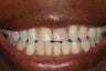 Cosmetic Dentistry