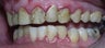 Sedation Dentistry