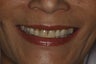 Smilemaker
