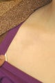 Tattoo Removal