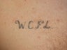 Tattoo Removal