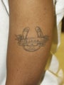 African American Tattoo Removal