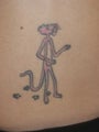 Tattoo Removal