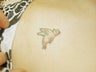Tattoo Removal