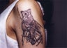 Laser Tattoo Removal