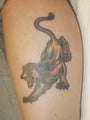 Tattoo Removal