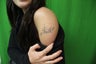 Laser Tattoo Removal