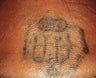 Laser tattoo removal