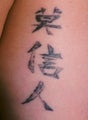 Laser tattoo removal