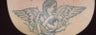 Laser tattoo removal